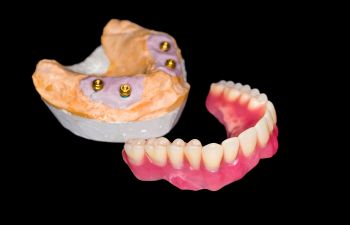 Removable Denture